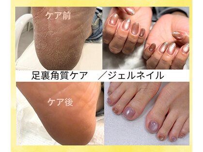 リケアネイル(Re:care nail)の写真