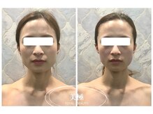 美極 銀座店/銀座/小顔コルギ/小顔矯正