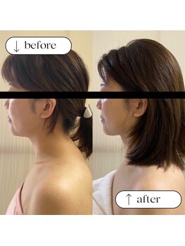 トータルビューティーサロンリア(Li'a)/ビフォー＆アフター