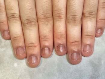 エルグラフィ(Lgraphy)の写真/自爪のケアに自信あります☆爪の形を整え、健康的な自爪へ♪お悩みを解消しながら、美しい指先に★