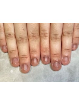 爪の悩みを解消できる（ケア含む）