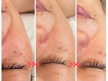 スリリアン 銀座/★お客さまビフォーアフター★