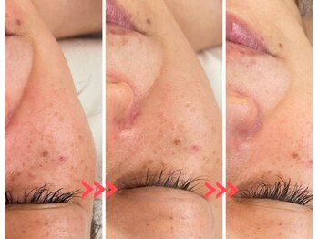 スリリアン 銀座/★お客さまビフォーアフター★