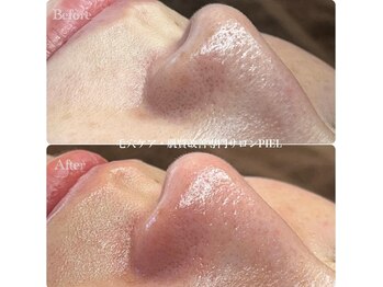 ピエル 北千住店(PIEL)/毛穴汚れ溜まりづらくするには?