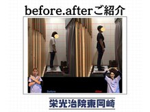 栄光治院 整体院東岡崎/岡崎/東岡崎/整体/腰痛/肩こり