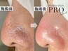つる艶実感☆毛穴美人コース約80分 ¥14000→¥11000 2回目以降割引きあり