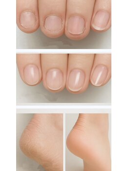 ネイル フライガール(nail FLY GIRL)の写真/爪に優しい★【育爪・ケア込】深爪・ちび爪・自爪風クリアネイル￥9990→￥6990★カカトのケアもお任せ♪