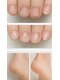 ネイル フライガール(nail FLY GIRL)の写真/爪に優しい★【育爪・ケア込】深爪・ちび爪・自爪風クリアネイル￥9990→￥6990★カカトのケアもお任せ♪
