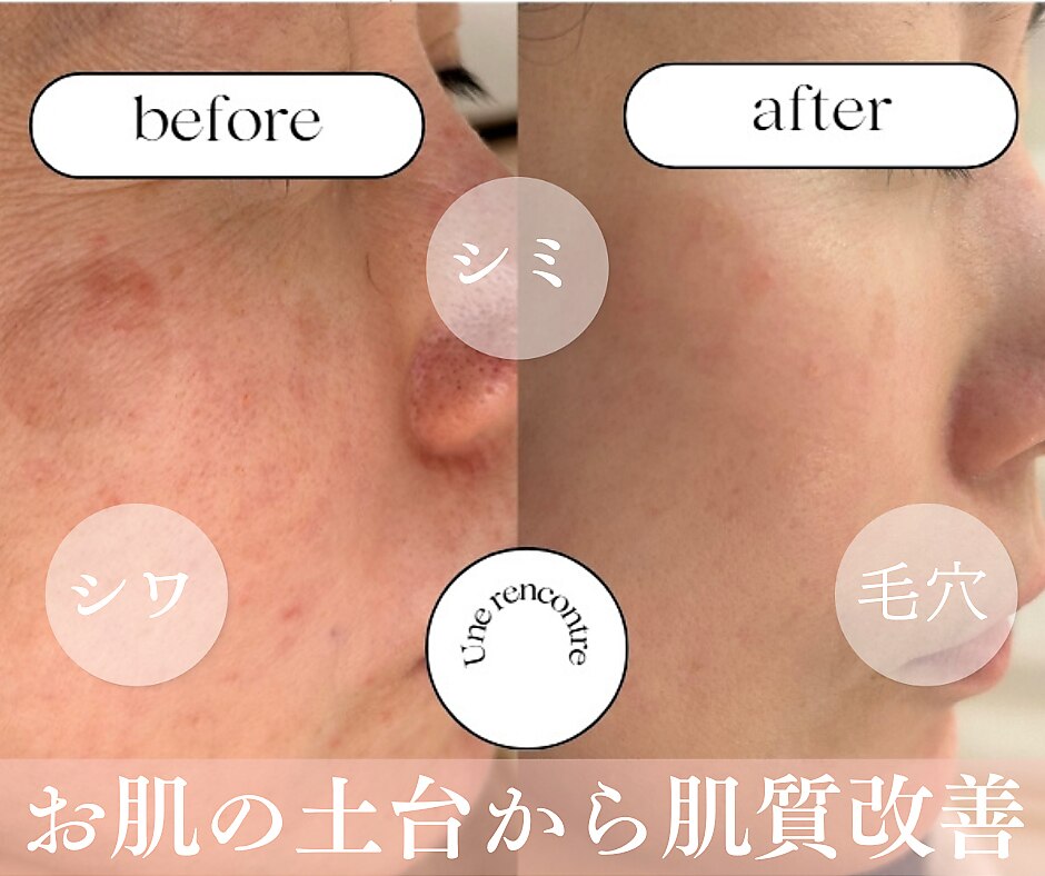 岐阜市でEMSが人気のエステサロン｜ホットペッパービューティー