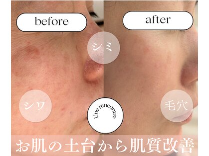 ユヌランコント 岐阜店(Une rencontre)の写真