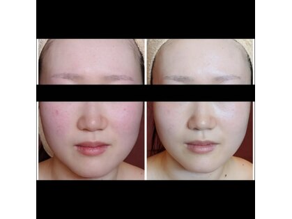 ナコズ エステティック(Nakos esthetic)の写真