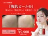 【Xmas前に肌ツヤUP♪】REVI新施術　『陶肌ピール』　¥11,000→初回¥9,900