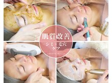 オリエンタルビューティー(ORIENTAL BEAUTY)