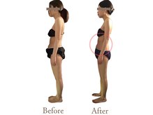 アダム(Adam)/お腹・背中など上半身痩身の変化