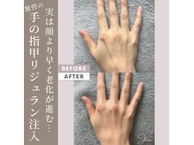 ジェモ(Jemo)の雰囲気（エステダーマで手の指甲までリジュラン注入！シミくすみしわケア）