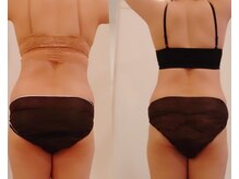 ケイ(K)/【防府】ダイエット｜痩せたい