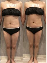 ヴィム(VIM)/ハイパーナイフビフォーアフター