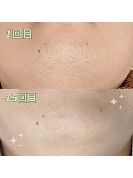 ロッソ ウオモ(ROSSO Uomo)/