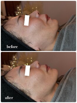 ウルラ(ULULA)/余白の無い横顔へ!