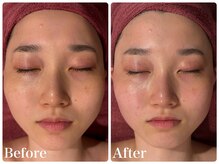 エステティック レイビス 青森店(RAYVIS)/劇的！？小顔フェイシャル！