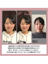 ピオニー(Peony)/Before & After
