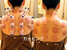 ソルーナ(So-Luna)の雰囲気（カッピング＆スライドカッピングで血行・老廃物の排出を促進。）
