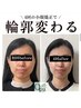 【小顔矯正+美肌美顔器4回モニターコース】通常￥48,400→モニター￥26,400