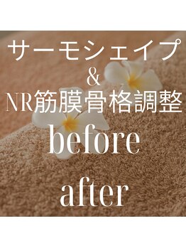 リラクゼーションサロン ラキ(laki)/サーモシェイプ/NR
