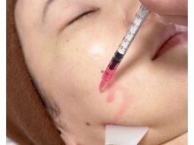 ミセル(MISEL2nd)/脂肪分解美容液レッドショット★