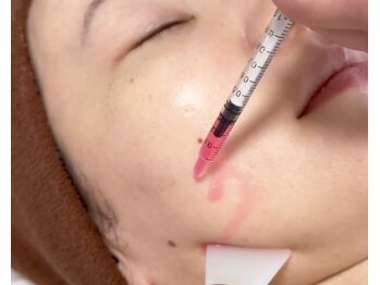 ミセル(MISEL2nd)/脂肪分解美容液レッドショット★