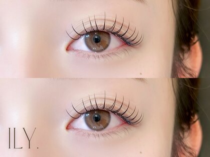 アイリー(ily)の写真