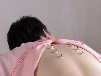 オンズ(on's)/施術/お灸