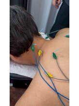 はまの整骨鍼灸院/首・肩の鍼（こちらは電気鍼）