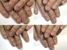 深爪矯正＆自爪矯正【どのメニューを選べばいいかわからない当日施術希望】