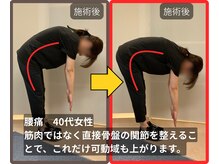 まこと整骨院/30代女性　腰痛　肩こり　首こり