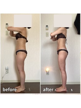 エソール(essor)/気になるお腹周りに変化を