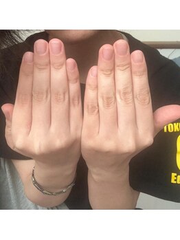 カンパニュラ(Campanula)/公式ラインからご相談