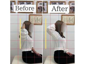 ナオル整体 仙台長町院(NAORU整体)/整体・矯正ビフォーアフター