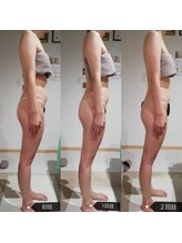 RiとBiのたまご/（BODY）最新機むくみケア