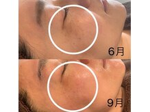 モドス(MODOS)の雰囲気（MODOSで美肌の土台作り！WAX×VOSでシミ改善◎）
