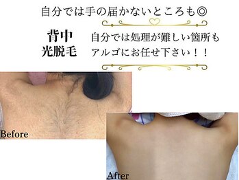 アルゴ 伊勢崎店(ALGO)/ コース開始前→コース10回