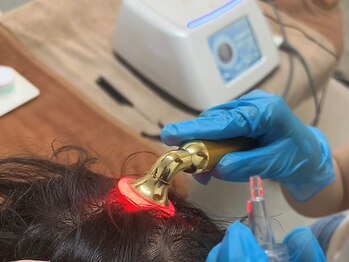 ソナヴォート(Sun Vuoto)の写真/《育毛促進×韓国美容》で気になる生え際にアプローチ◎最先端技術で本気の育毛促進ケア♪