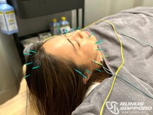 ラナスサッポロ(RUNUS SAPPORO)の雰囲気(【美容鍼】睡眠不足/眼精疲労/頭痛/自律神経の乱れ/小顔効果)