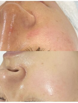 ユミサロン(U Mi Salon)/毛穴の悩みプロが根本からクリア