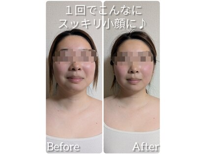 ヨサパーク アエル(YOSA PARK AELL)の写真