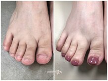 ネイルズシアムの雰囲気（深爪矯正について詳しくはホームページをご覧ください）