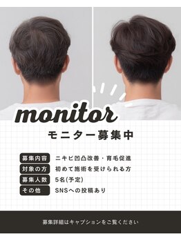 シーライン(Cline)/施術モニター様募集中