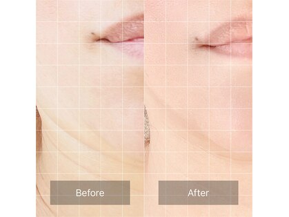 ウツクシ 三軒茶屋(UTUKUSHI)の写真