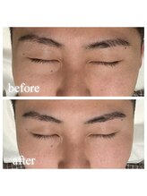 リノア(Linoa)/メンズ眉毛デザイン脱毛