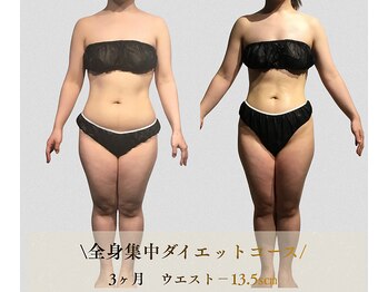 サンテボーテ(Sante Beaute)/お腹周り改善｜２サイズダウン